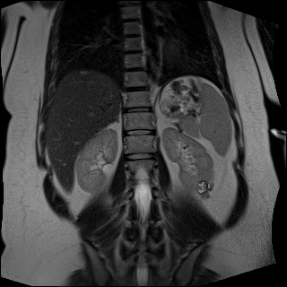 Abdominal & Pelvic