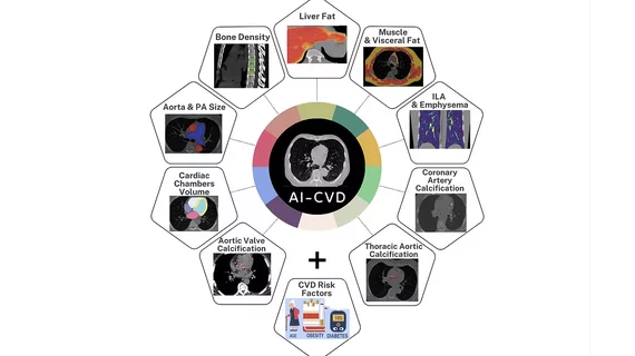 AI-Enhanced preventative CT screening at Georgia Health Imaging