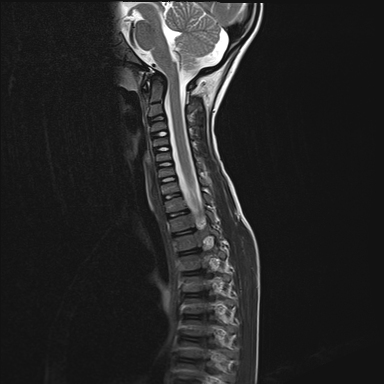 Spine & Musculoskeletal